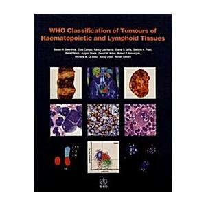 Who Classification of Tumours of Haematopoietic and Lymphoid Tissues ...