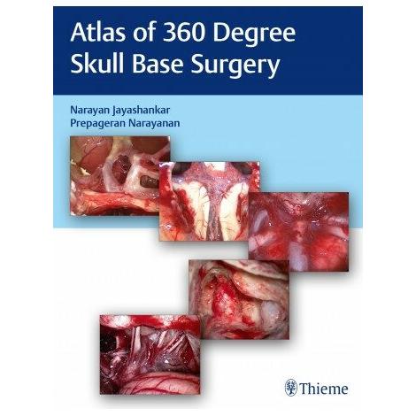 Atlas of 360 Degree Skull Base Surgery (Hardcover)