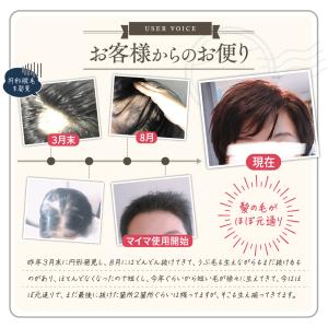 育毛剤 女性用 医薬部外品 40代 50代 6...の詳細画像5
