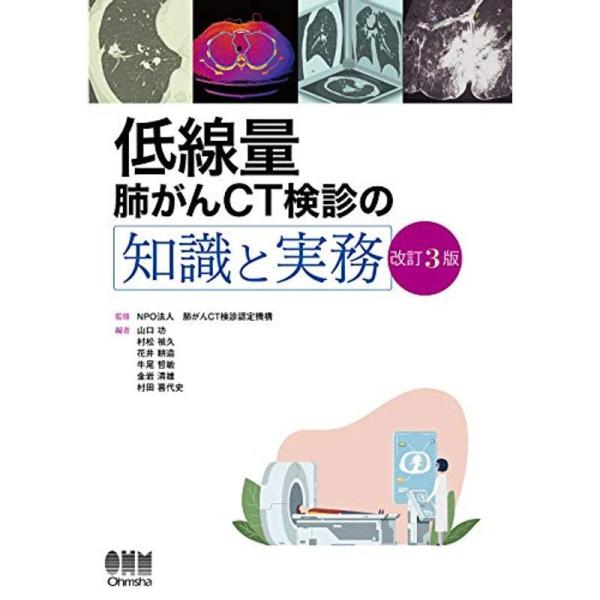 低線量肺がんCT検診の知識と実務(改訂3版)