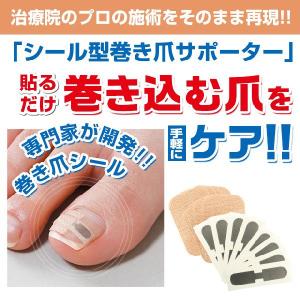 レジスタントプレート　Resistance Plate スターターキット　巻き爪 □RESISTANCE PLATE(レジスタンスプレート)商品一覧 / NES