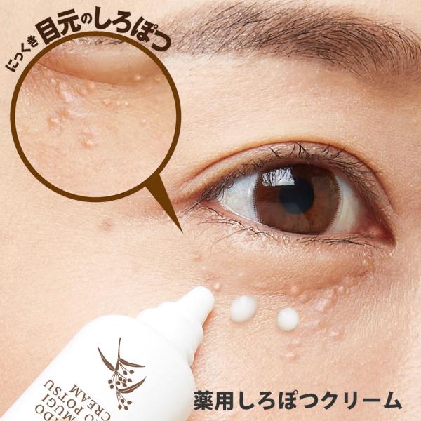 薬用しろぽつクリーム 15g 目の周り 白い ポツポツ 集中ケア いぼ イボ 顔 目元 クリーム 日...