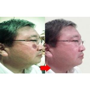 薬用シミ取りクリーム 男性用 Beクリアホワイ...の詳細画像1