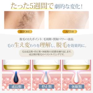 【レビュー特典開催!】光脱毛器 全身 VIO対...の詳細画像4