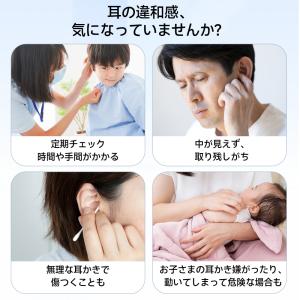 【ランキング1位】 耳かき カメラ LEDライ...の詳細画像5