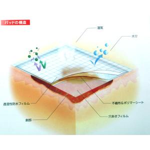 白十字 モイスキンパッド 7520 滅菌済 1...の詳細画像2