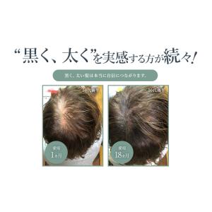 薄毛 白髪 対策 薬用 育毛剤 GROXIL ...の詳細画像3