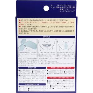 いびき防止具として特許マウスピース 2サイズ各1個入の詳細画像1