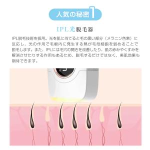 IPL光脱毛器 冷感脱毛 VIO脱毛 光美容器...の詳細画像4