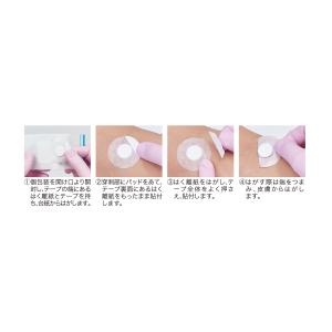 インジェクションパッド No.36A 止血用パ...の詳細画像1