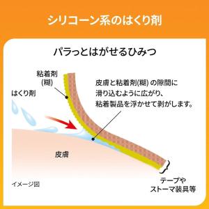 キャビロン 皮膚用リムーバー TP1-L50 ...の詳細画像3