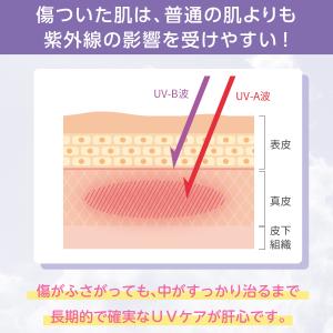 skinix エアウォールUV 25mm×3m...の詳細画像1