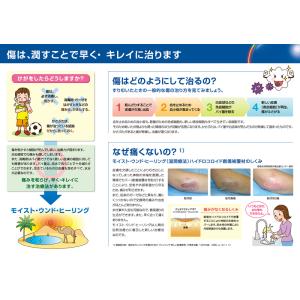 デュオアクティブET 10cmx10cm 10...の詳細画像4