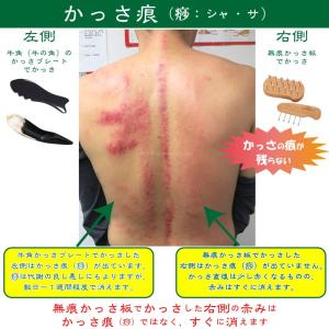 無痕かっさ板 大小セット 本体のみ備品なし「あ...の詳細画像2