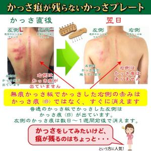 無痕かっさ板 大小セット 本体のみ備品なし「あ...の詳細画像3