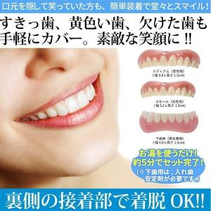 インスタントスマイル 仮歯 付け歯 前歯 入れ歯 ワンタッチ