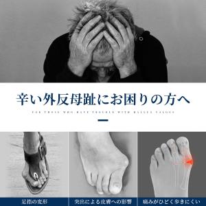 外反母趾サポーター 足指矯正 足指サポーター ...の詳細画像1