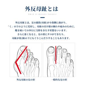 外反母趾サポーター 足指矯正 足指サポーター ...の詳細画像2
