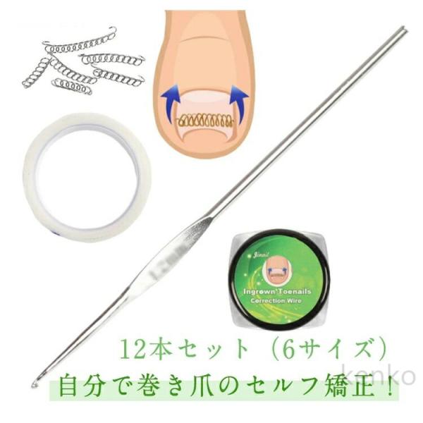 巻き爪矯正グッズ 巻き爪チェーン 巻き爪 巻きづめ 防止 巻き爪チェーン ワイヤー ガード 矯正テー...