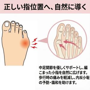 内反小趾 ないはんしょうし サポーター 小指 ...の詳細画像2