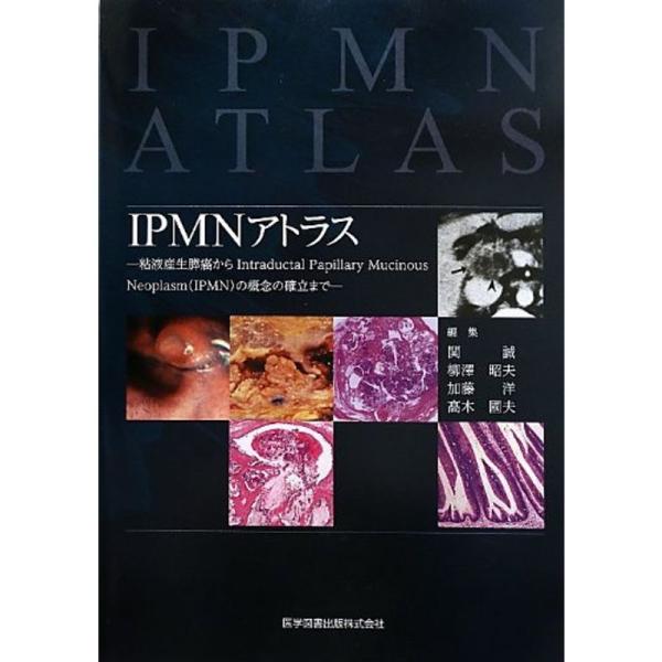 IPMNアトラス?粘液産生膵癌からIntraductal Papillary Mucinous Ne...