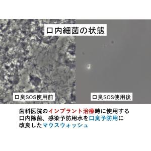 口臭ケア 口臭対策 口臭予防 口臭の原因 口臭...の詳細画像4