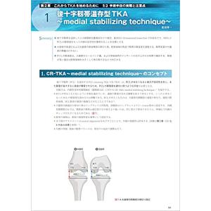 TKA・UKA 人工膝関節置換術パーフェクト?...の詳細画像2