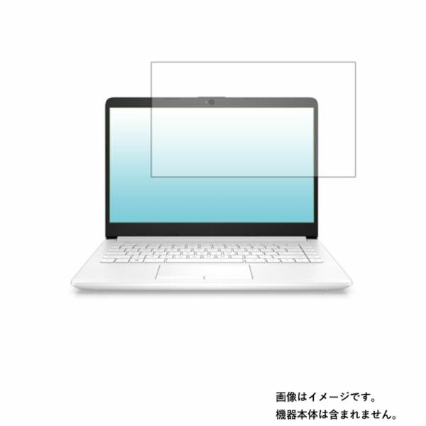 HP 14s-cf2000 2020年モデル 用 N35 安心の5大機能 衝撃吸収 ブルーライトカッ...