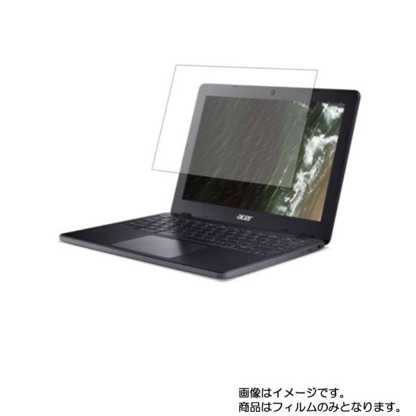 Acer Chromebook 712 2020年10月モデル 用 10 安心の5大機能 衝撃吸収 ...