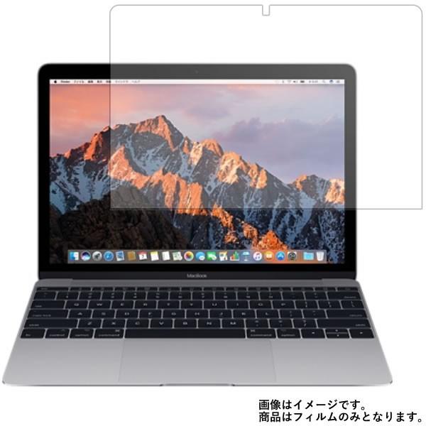 Apple MacBook 12インチ 2017年モデル 用 10 安心の5大機能 衝撃吸収 ブルー...