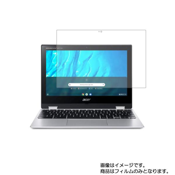 Acer Chromebook Spin 311 2020/22年モデル 用 N30 マット(反射低...