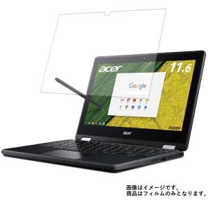 Acer Chromebook Spin 11 R751TN-N14N 2017年8月モデル 用 N30 マット 反射低減 液晶保護フィルム