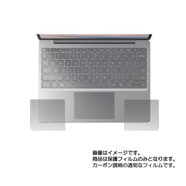 Microsoft Surface Laptop Go (12.4インチ)用 カーボン調 パームレス...