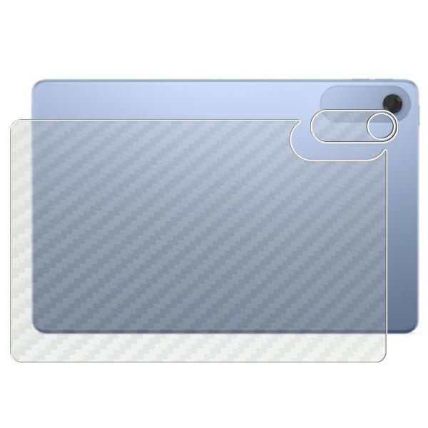 NEC LAVIE Tab Lite TL103/KAL 2025年夏モデル 用 10 カーボン調 ...