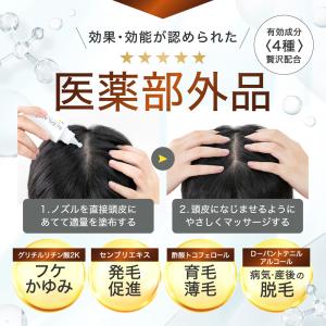 頭皮保湿ローション フケ かゆみ 頭皮臭 乾燥...の詳細画像4