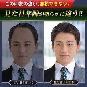 育毛剤 豪爽 薬用育毛剤 育毛トニック 発毛剤...の詳細画像3