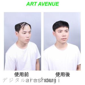 ウィッグ 部分ウィッグ メンズかつら 中高年向...の詳細画像2