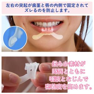 いびき 軽減 マウスピース 特許取得 日本製 ...の詳細画像3