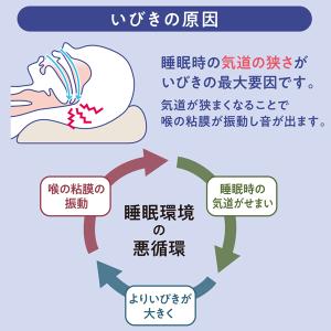 いびき 軽減 マウスピース 特許取得 日本製 ...の詳細画像4