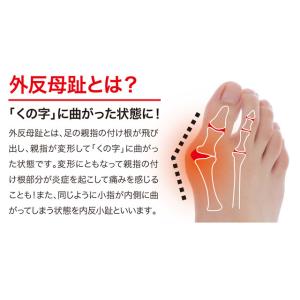 外反母趾 内反小趾 サポーター 足指 広げる ...の詳細画像5