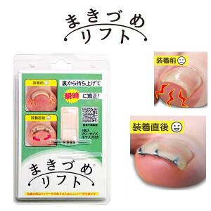 巻き爪 まき爪 リフト ワイヤー 巻き爪ケア サイズ調節可能 日本製 まきづめリフト メB｜motebeauty