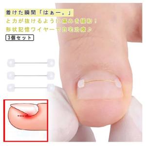 親指 巻爪 矯正 まきつめ 足 シール テープ...の詳細画像5
