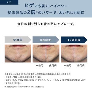 【冷却+ハイパワー速攻ケア】最新モデル 冷却機...の詳細画像4