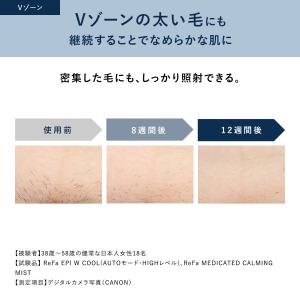 【冷却+ハイパワー速攻ケア】最新モデル 冷却機...の詳細画像5