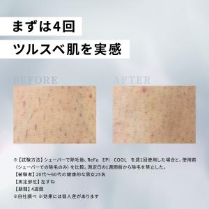 【安心の延長保証セット!】 リファエピ クール...の詳細画像4