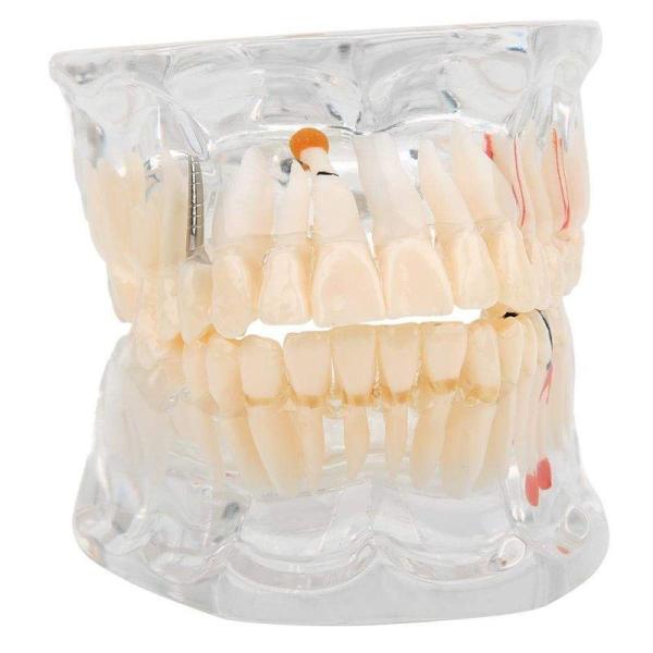 歯 模型 歯列 歯科模型 歯科研究モデル 歯模型 透明 上顎/下顎模型 研究指導 歯科学習 教育 学...