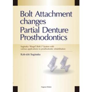 Bolt Attachment changes Partial Denture Prosthodontics｜nagasueshoten