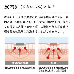 中山式 ひ鍼 96針 鍼シール 置き鍼 皮内鍼...の詳細画像3