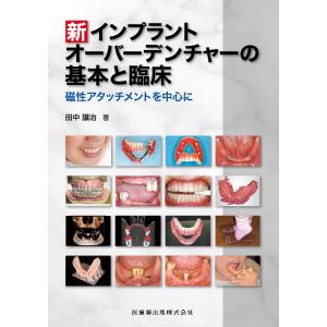 新インプラントオーバーデンチャーの基本と臨床 磁性アタッチメントを中心に 田 (中古品)