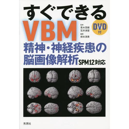 【送料無料】[本/雑誌]/すぐできるVBM 精神・神経疾患の脳画像解析 SPM12対応/青木茂樹/監...